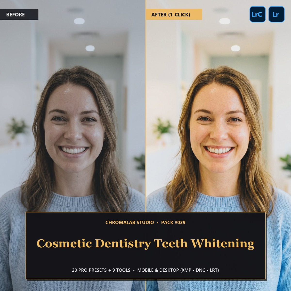 Cosmetic Dentistry Teeth Whitening — 20 Lightroom Presets (Mobile & Desktop) - Cover
