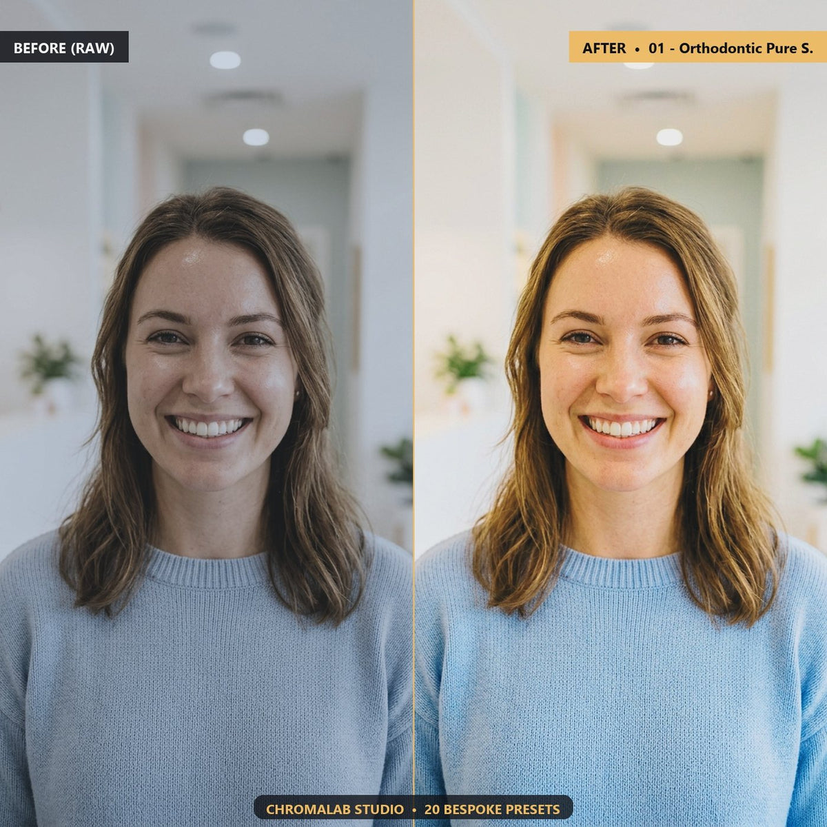 Cosmetic Dentistry Teeth Whitening - Before & After Split